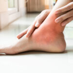 Kobieta trzyma się za bolącą stopę. Ortopeda stóp, czy może jednak podolog?